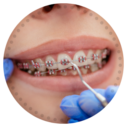 Best Orthodontist Near Me